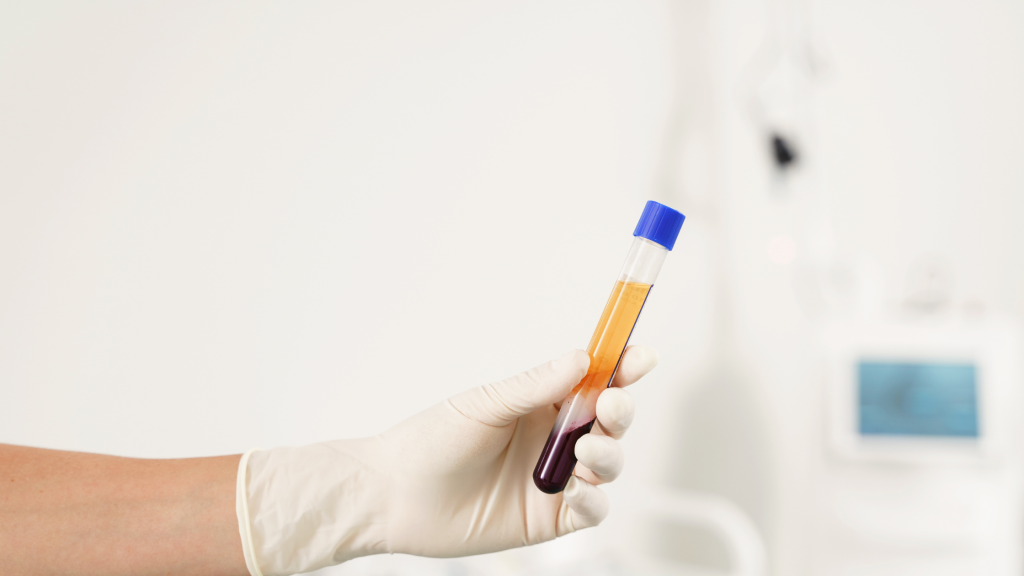 Platelet-Rich Plasma (PRP) therapy process illustration