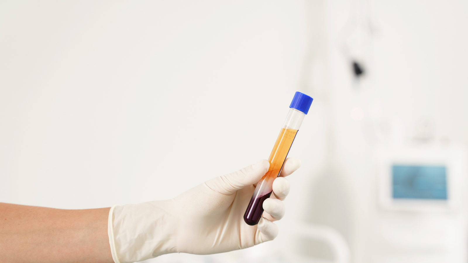 Platelet-Rich Plasma (PRP) therapy process illustration